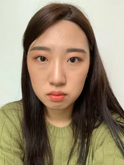 [Mắt] Sharalla - Chỉnh sửa mắt không phẫu thuật, mở góc mắt trong, tái tạo mỡ dưới mắt