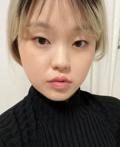 [Mắt] Mongsiri - Chỉnh sửa mí mắt không phẫu thuật