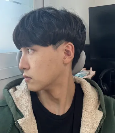 [Nam] 븽븽 - Chỉnh sửa mắt hai mí (phẫu thuật cắt mí), nâng mũi, gọt mặt 3 điểm