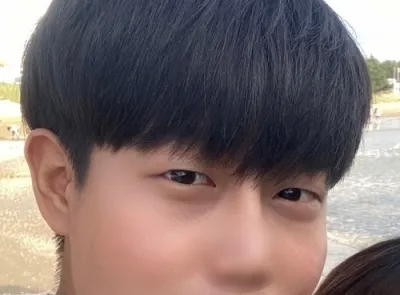 [Nam] Yu Kang - Chỉnh sửa mí mắt bằng phương pháp rạch