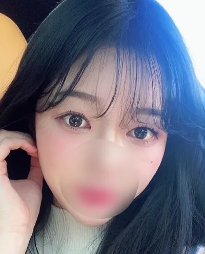 [Mắt] Pomodoro - Cắt mí (Tái phẫu thuật)