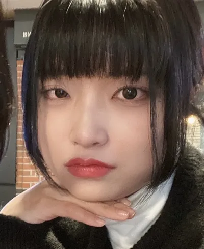 [Mắt] Jangnyeong - Tái phẫu thuật chỉnh sửa sụp mí (phương pháp rạch)