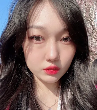 [Mắt] Sally - Tái định vị bọng mỡ dưới mắt