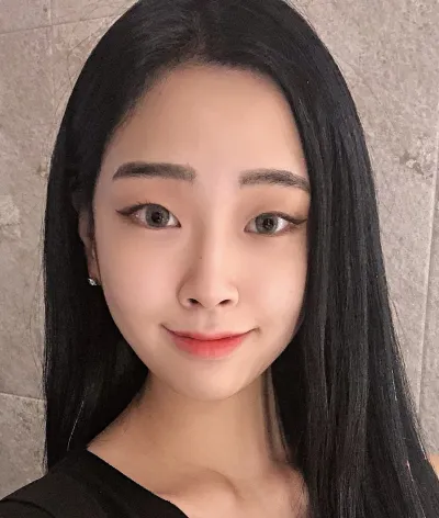 [Mắt] Nara - Bấm mí, mở rộng góc mắt ngoài, mở rộng góc mắt dưới