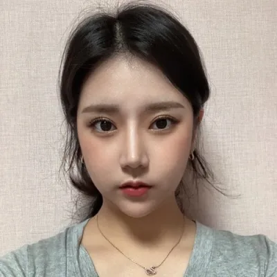 [Mũi] Neoongoo - Nâng sống mũi, thu nhỏ đầu mũi, gọt xương mũi gồ