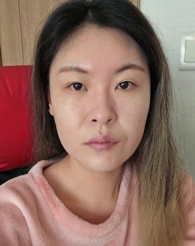 [Mắt] Chorogi - Bấm mí, mở góc mắt sau, mở góc mắt dưới