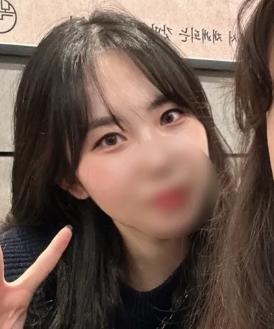 [Mắt] Ojjo Jjo - Tái phẫu thuật cắt mí