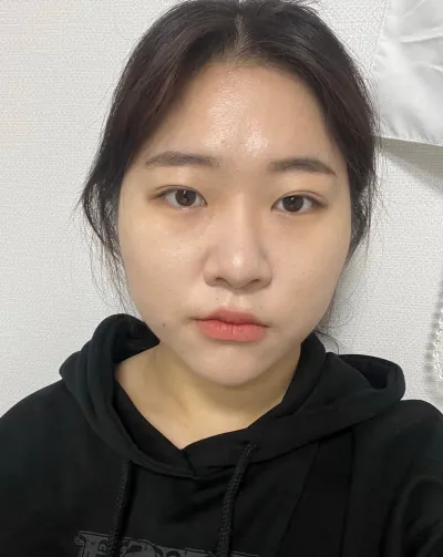 [Mắt] Cheli Jelly - Mở rộng góc mắt ngoài, mở rộng góc mắt dưới