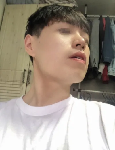 [Gọt mặt] Koz802 - Góc hàm, cằm, sống mũi