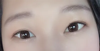 [Mắt] Ổn áp - Mắt