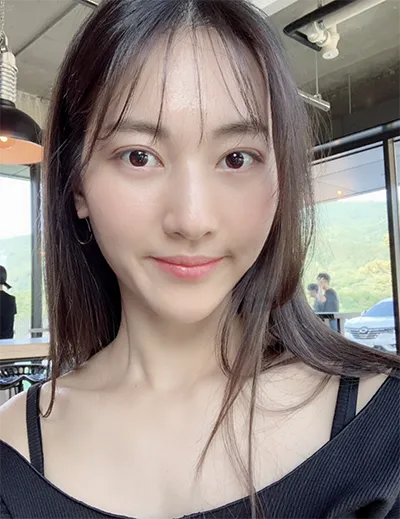 [Mắt] Park Myung-soo - Mắt, Filler