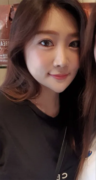 [Mũi] Pơ-Piu - Mắt, Mũi, Cấy Mỡ