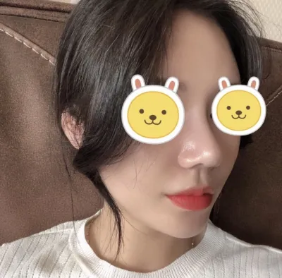 [Mũi] Vương Rùa - Mũi