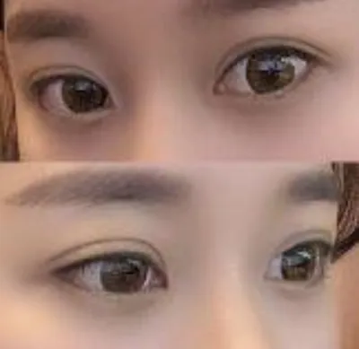 [Mắt] Đi ngắm hoa thôi - Chỉnh sửa mắt