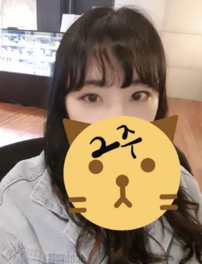 [Mắt] shshin7 - Hạ góc mắt ngoài, mở rộng góc mắt ngoài