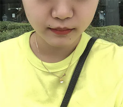 [Tiểu phẫu] Tuturami - Nâng cơ