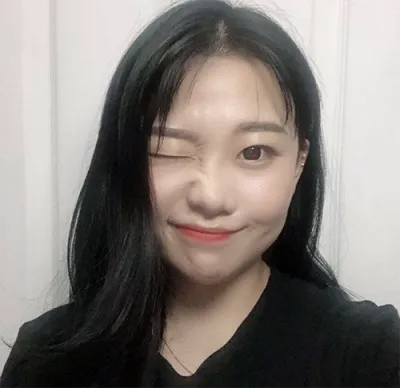 [Gọt mặt] Nya Na Nya Na Nyaang - Gọt hàm, độn cằm, gò má