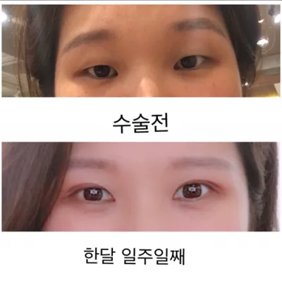 [Mắt] nalrae - Mắt