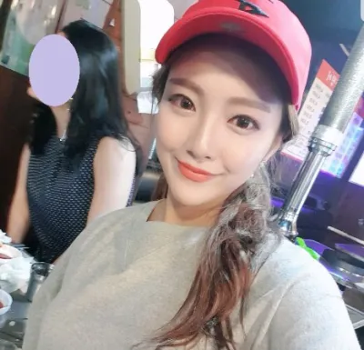 [Tiểu phẫu] Pururing - Tiêm filler mũi