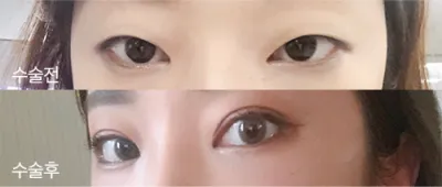 [Mắt] Eunmikami - Mắt