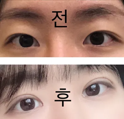 [Mắt] Yanggaeng Sopoo - Mắt