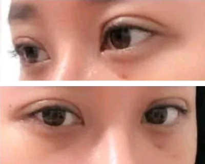 [Mắt] Romantic Tree - Mắt