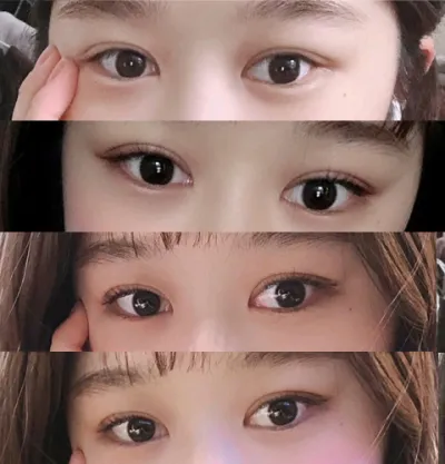 [Mắt] Shiro Shiro - Mắt