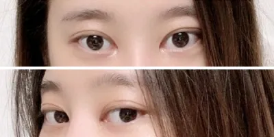 [Mắt] Doochi's - Mắt