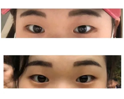 [Mắt] Jibamba - Mắt