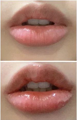 [Tiểu phẫu] Yoon Sorimi - Môi