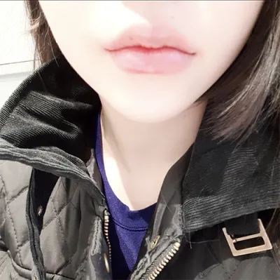 [Tiêm filler] *99* - Môi