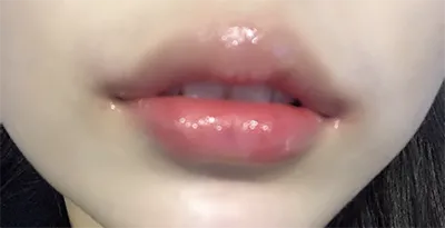 [Tiểu phẫu] lol - Môi