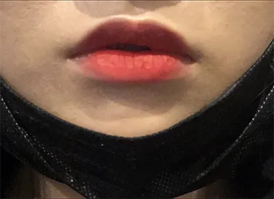 [Tiểu phẫu] Immi - Môi