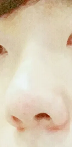 [Tiểu phẫu] Jung Dae-hoon - Mũi