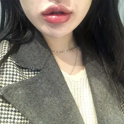 [Tiểu phẫu] Diet - Môi