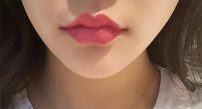 [Tiểu phẫu] Ố á - Môi