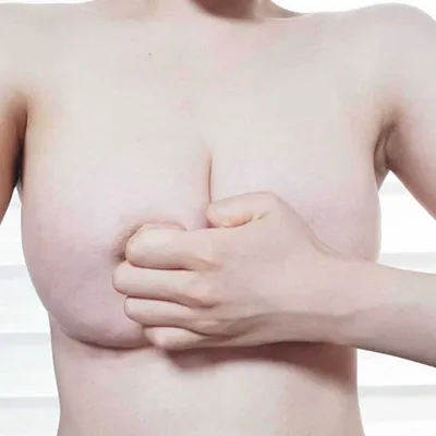 [Ngực] Như quả dưa hấu - Ngực