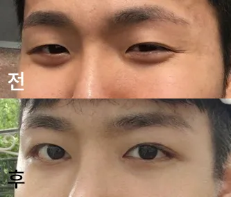 [Mắt] Chirnio - Mắt