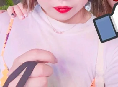 [Tiêm filler] Bully Bully Kyaak - Tiêm filler môi