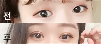 [Mắt] Súp In - Mắt