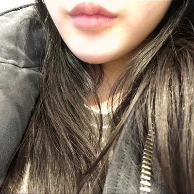 [Tiểu phẫu] yghvj - Cằm