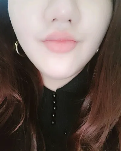 [Tiêm thẩm mỹ] Alrokdalok Milk - Tiêm tạo hình mũi