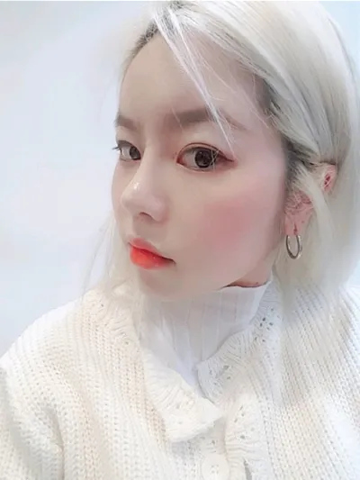 [Mũi] Wangnuni00 - Mũi, Mắt, Cấy Mỡ