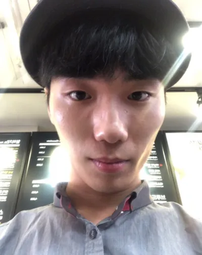 [Đàn ông] Starbitna - Mắt, gọt hàm, gò má