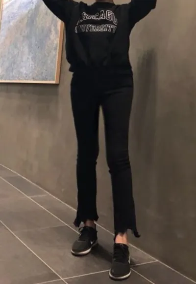 [Hút mỡ] Tuyệt vời - Hút mỡ