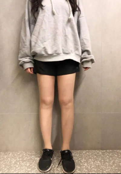 [Hút mỡ] Kyak Gik Kyak - Hút mỡ