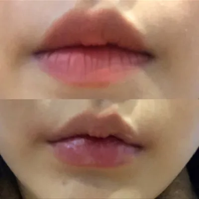 [Tiểu phẫu] Jjiningnini - Môi