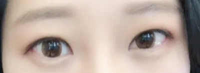 [Mắt] Ổn áp - Mắt