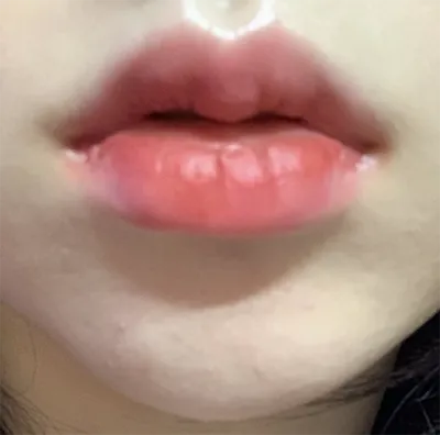 [Tiểu phẫu] m8n - Môi