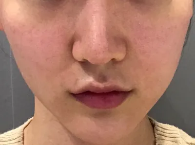 [Da] nomango - Lỗ chân lông